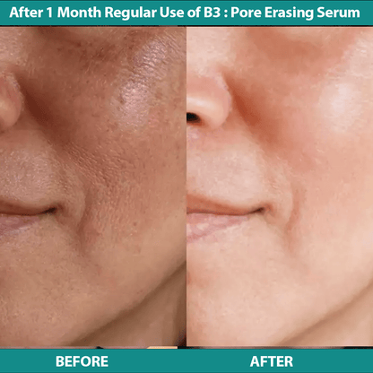 Bluemist B3 : Pore Erasing Serum